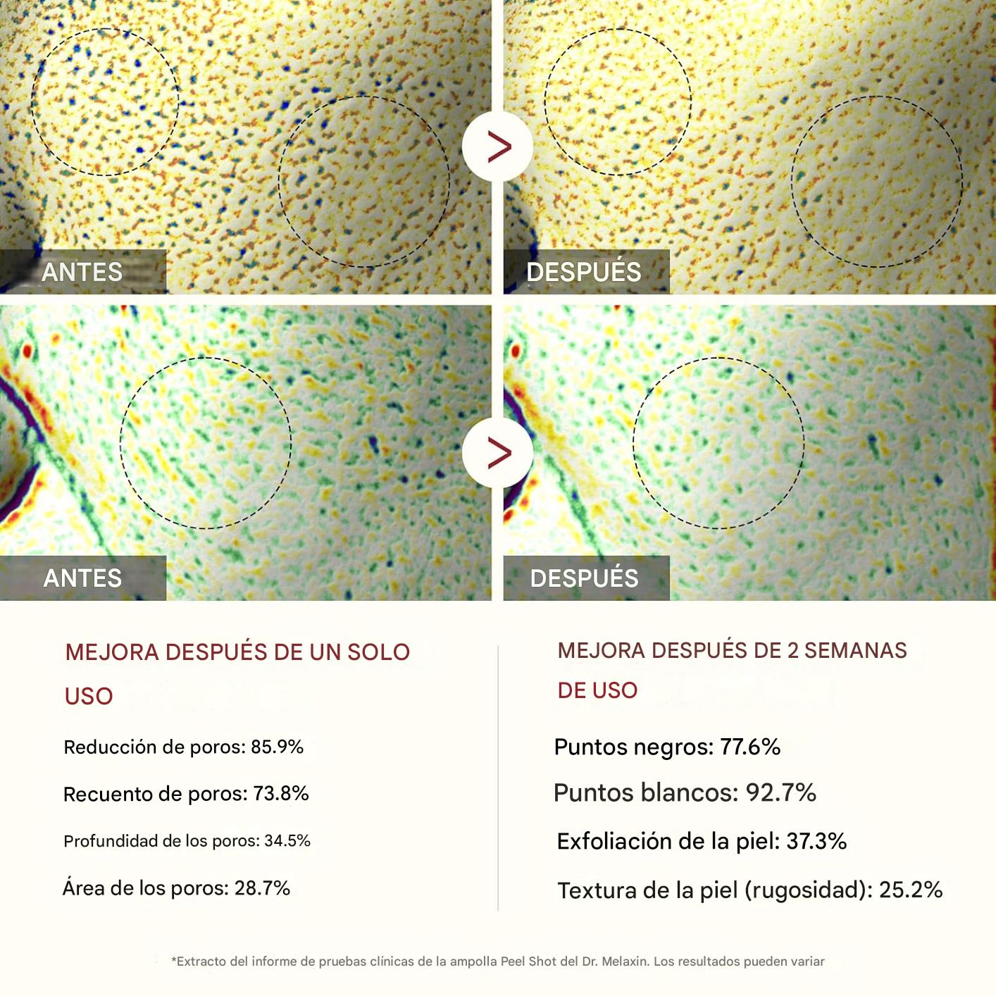 InfiniteShot - Ampollas exfoliantes de arroz
