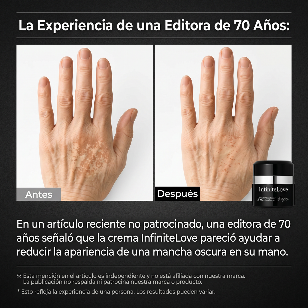 Crema Despigmentante Intensiva – Reduce Manchas y Unifica el Tono