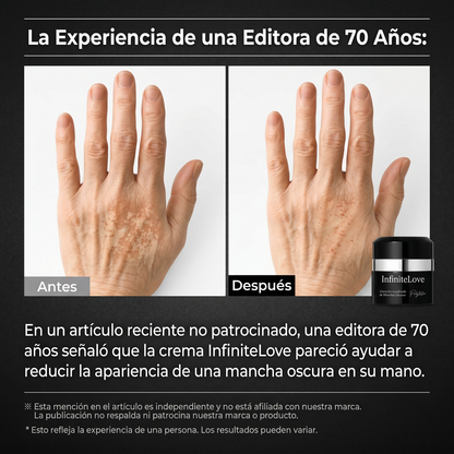 Crema Despigmentante Intensiva – Reduce Manchas y Unifica el Tono