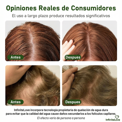 Champú Sólido Anticaída – Fortalece Raíces y Reduce la Caída del Cabello