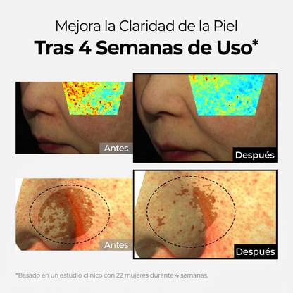 Crema Despigmentante Intensiva – Reduce Manchas y Unifica el Tono
