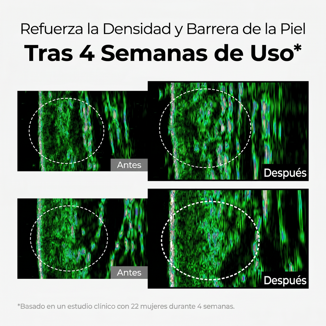 Crema Despigmentante Intensiva – Reduce Manchas y Unifica el Tono