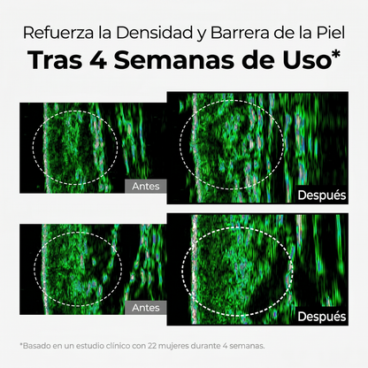 Crema Despigmentante Intensiva – Reduce Manchas y Unifica el Tono