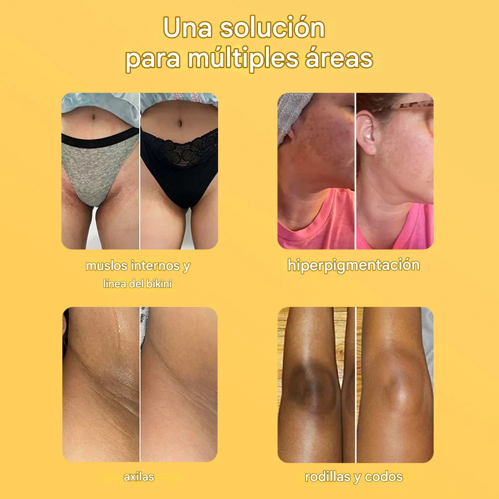 Barra de  jábon de Cúrcuma y Ácido Kójico