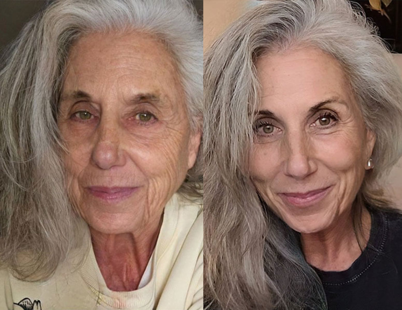 Antes y después Mariola P.