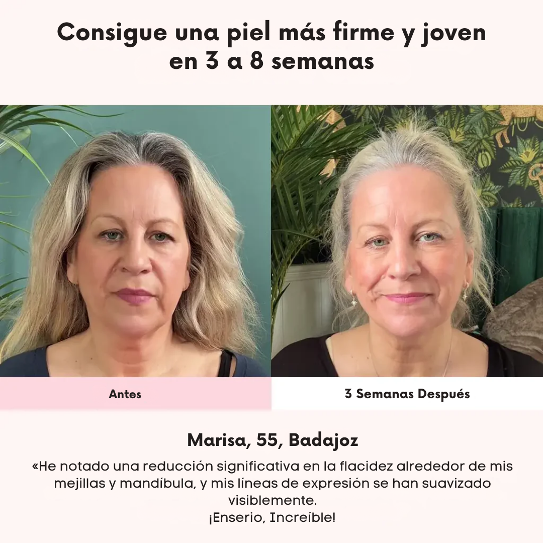 Máscara Facial Anti-Edad de 7 Colores LED y Microcorriente (EMS) para Lifting de Papada y Reafirmar Mejillas