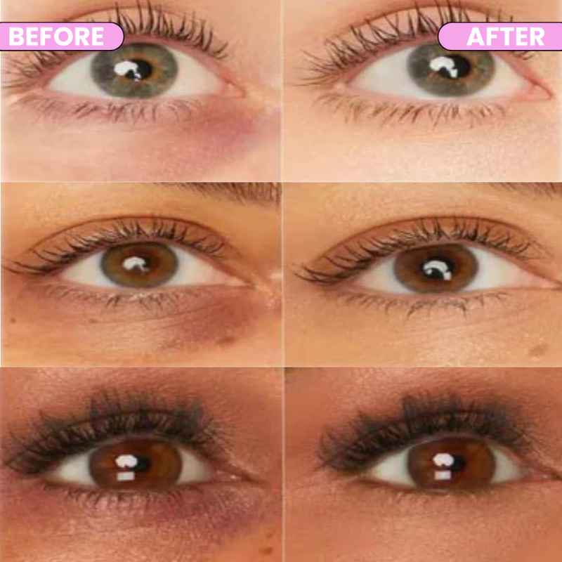 InfiniteSmooth - Corrector de Ojeras®