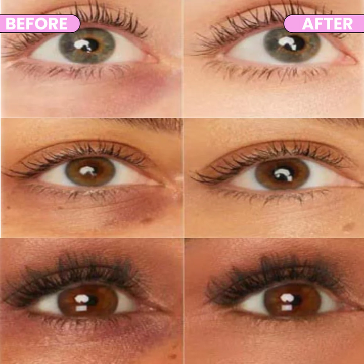 InfiniteSmooth - Corrector de Ojeras®