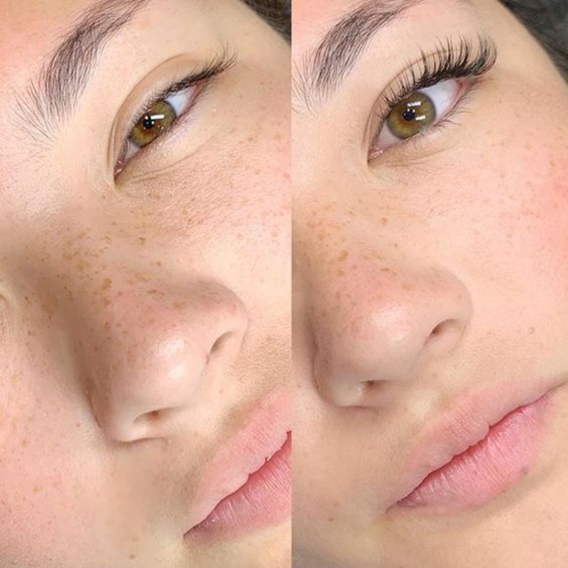 Sérum LashMagic®
