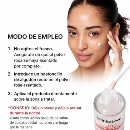 InfiniteLove Punto Rosa — Loción Secante con Calamina y Ácido Salicílico 20 ml