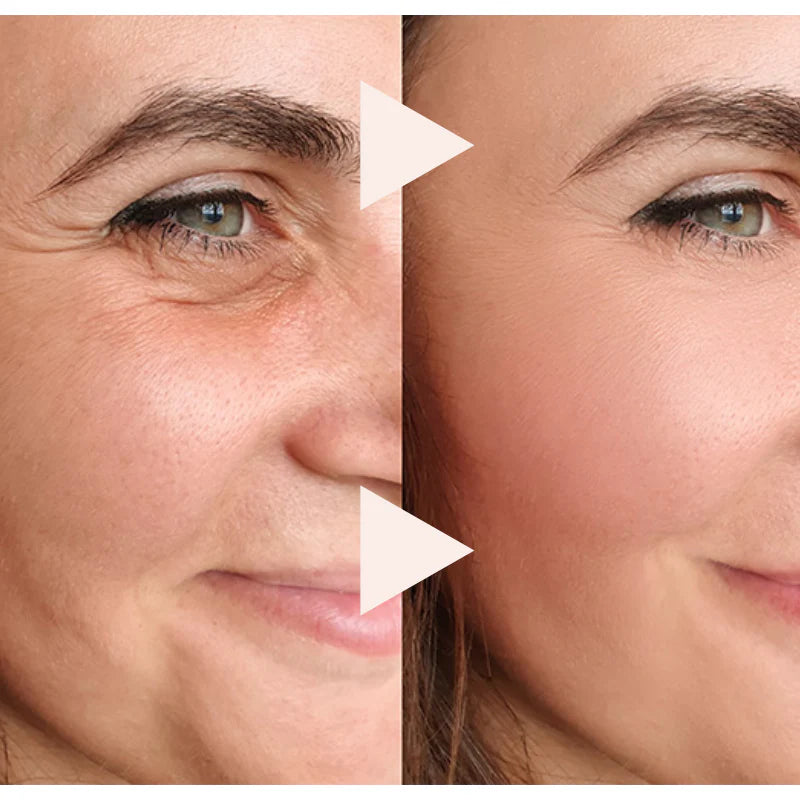 El Antiedad Exprés - Efecto Lifting Instantáneo