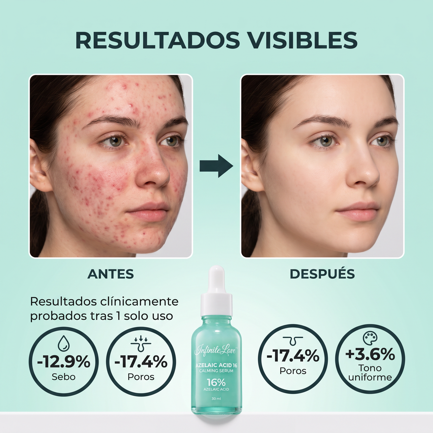 Sérum Calmante con Ácido Azelaico al 16% 30ml