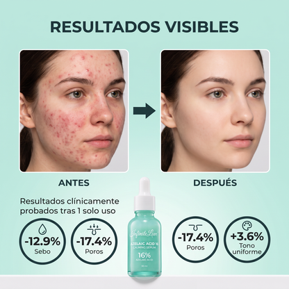 Sérum Calmante con Ácido Azelaico al 16% 30ml