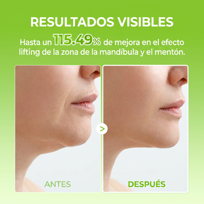 InfiniteLift - Banda Tensora V-Contour Efecto Frío (4 Uds)