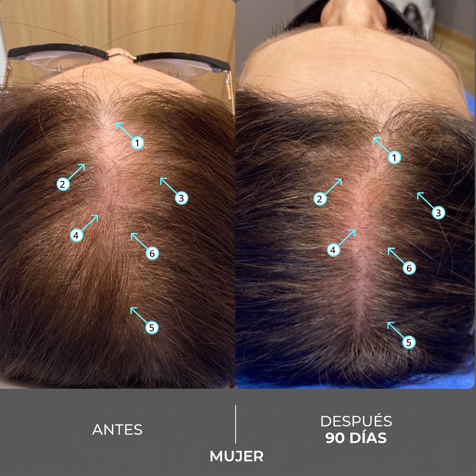 Antes y Después Mujer 90 Días