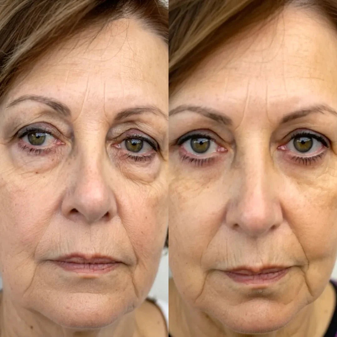 RevitaOjos - Dispositivo Antiedad de Luz Roja y EMS para Eliminar Bolsas, Ojeras y Hinchazón
