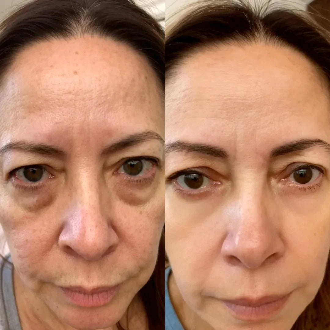RevitaOjos - Dispositivo Antiedad de Luz Roja y EMS para Eliminar Bolsas, Ojeras y Hinchazón