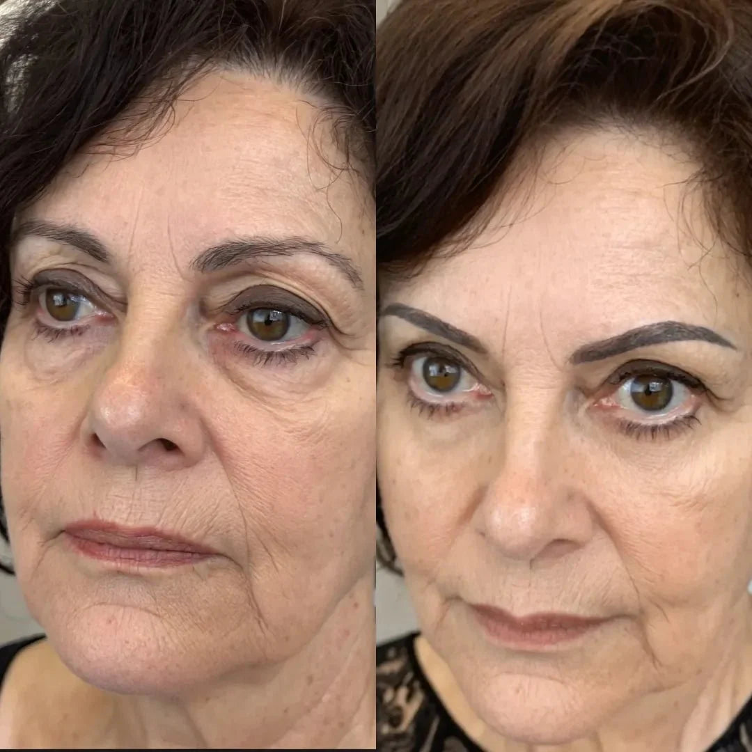 RevitaOjos - Dispositivo Antiedad de Luz Roja y EMS para Eliminar Bolsas, Ojeras y Hinchazón