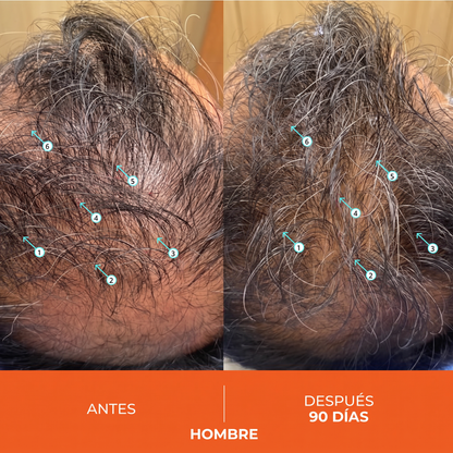 Antes y Después Hombre 90 Días 6 flechas