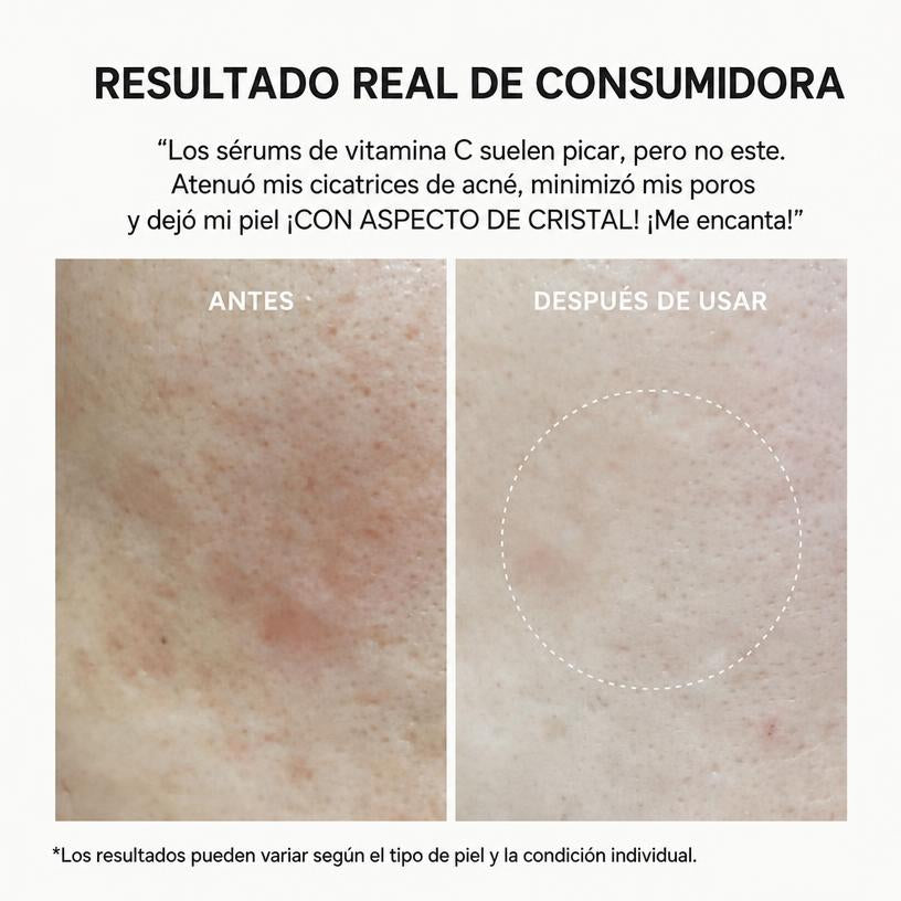 Sérum Vitamina C Booster Shot Glutatión Luminosidad Tono Uniforme K-Beauty 30ml