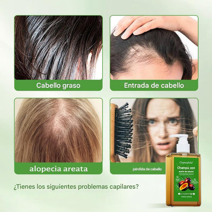 InfiniteBatana - Crece tu cabello