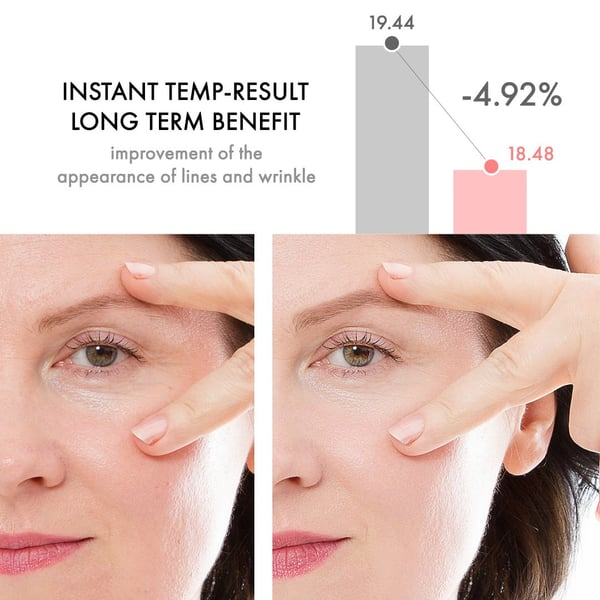 InfiniteBalm® – Firmeza y Tono
