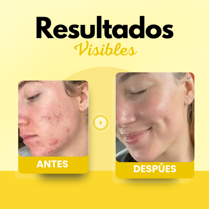 Bálsamo de Sebo de Res Para Reparación de Barrera y Piel Seca/Sensible