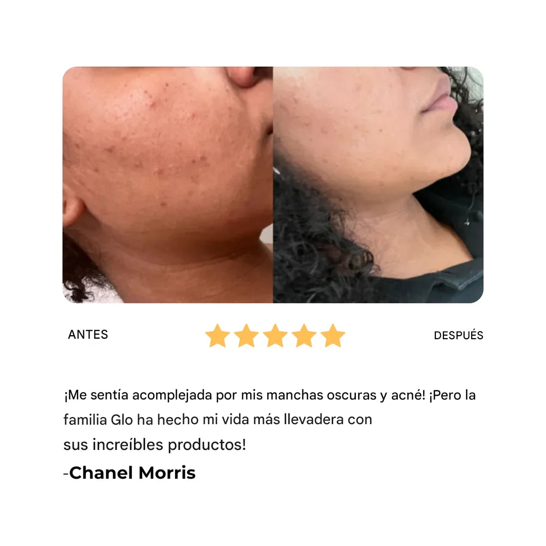 Barra de  jábon de Cúrcuma y Ácido Kójico