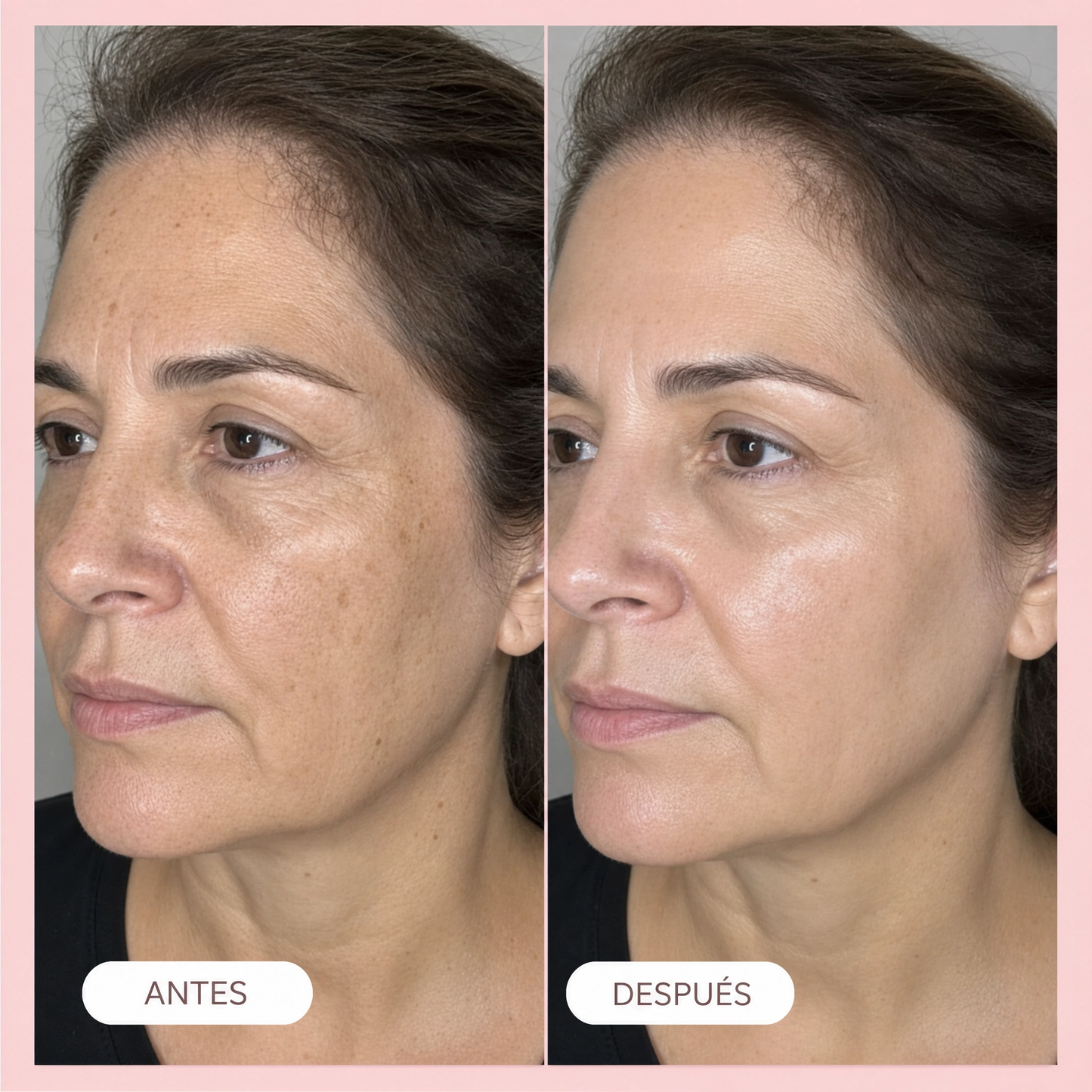Sérum Super C Multiusos · Vitamina C + Ácido Hialurónico