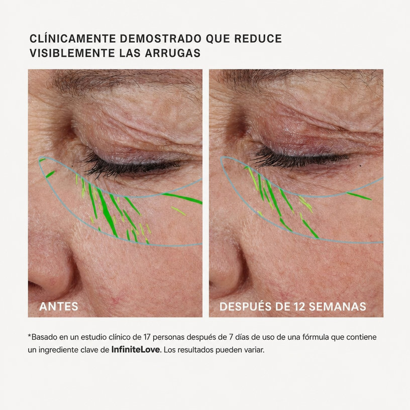 InfiniteLove BioLift — Sérum Reafirmante con Péptidos y Ceramidas 30 ml