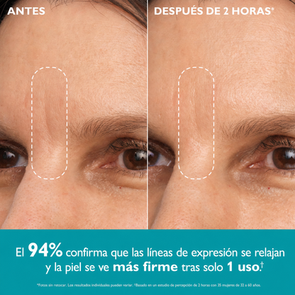 Antes y después - Frente