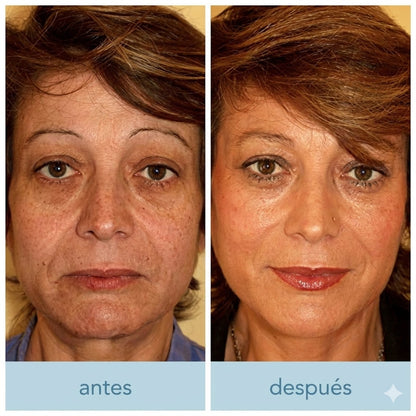 Suero Facial Anti-Edad | 'Efecto Lifting' para Arrugas y Flacidez