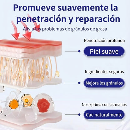 InfiniteCare - Tratamiento facial para milia