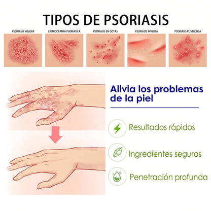 Crema Reparadora para Piel Sensible - Fórmula Botánica Calmante 20g