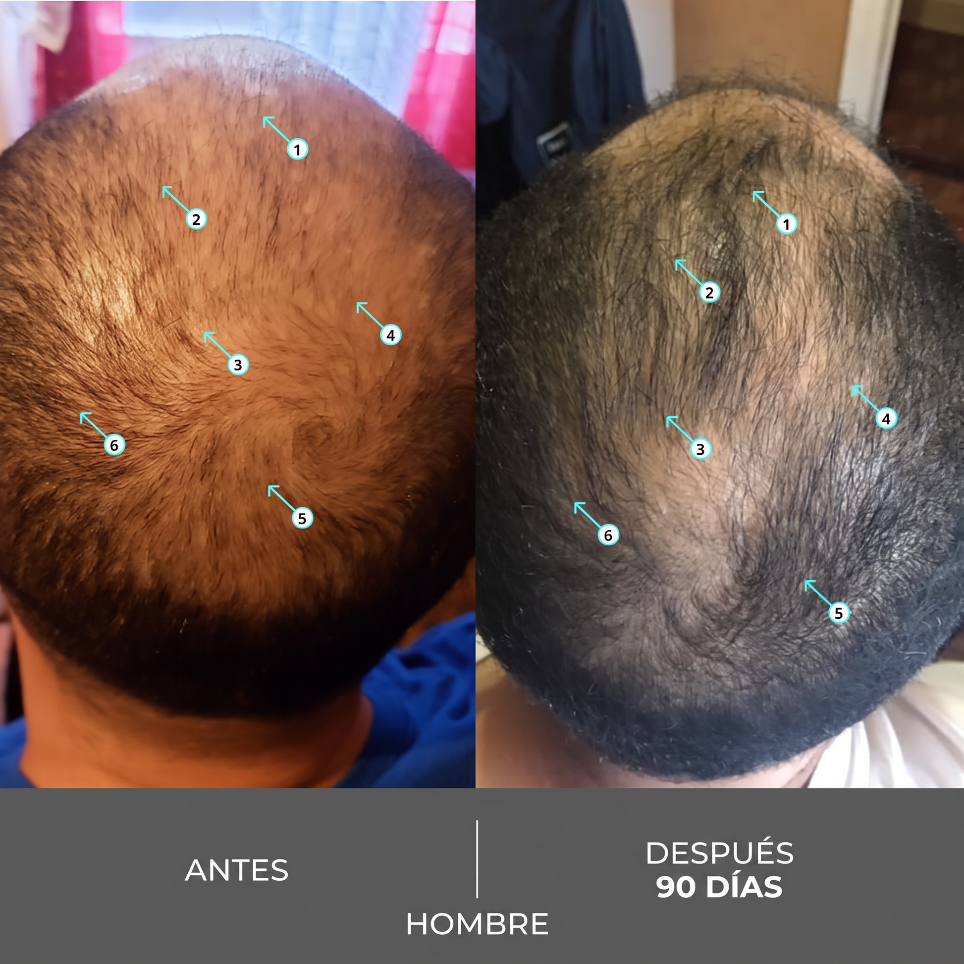 Antes y Después Hombre 90 Días