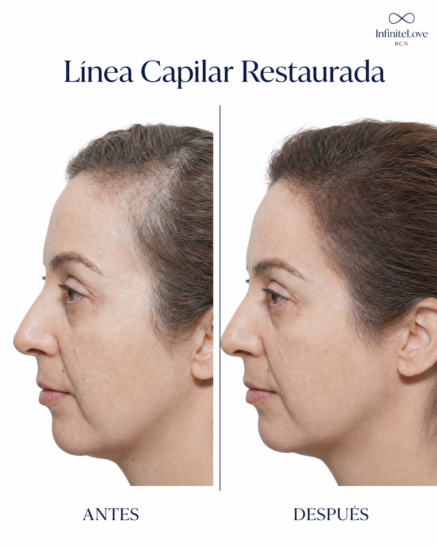 Sérum Capilar de Crecimiento